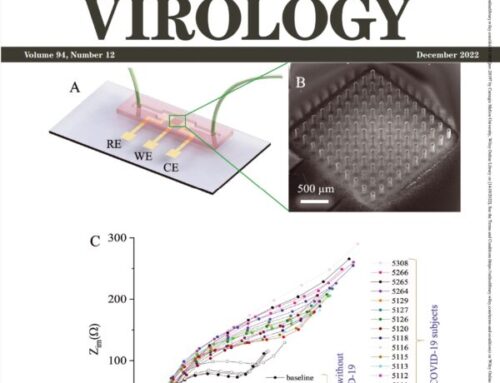 Azahar’s paper on human trials of the 10 s Covid-19 test featured as the front cover of Journal of Medical Virology. Congratulations!